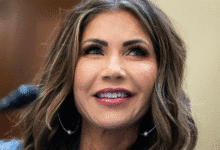 Kristi Noem Plastic Surgery